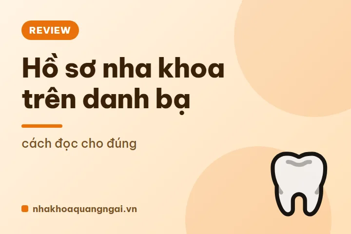 Bọc răng sứ hay trám răng: chọn thế nào cho đúng