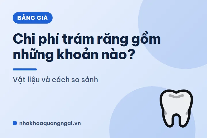 Chi phí trám răng gồm những khoản nào? Vật liệu và cách so sánh