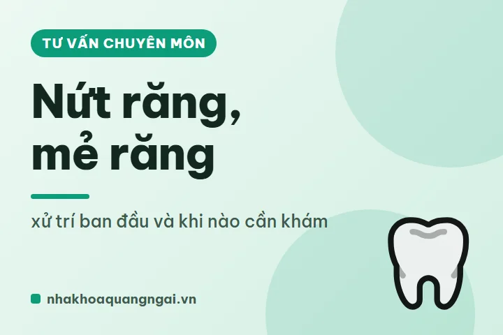 Nứt răng, mẻ răng: xử trí ban đầu và khi nào cần khám