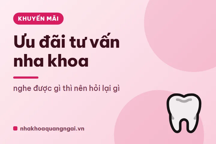 Niềng răng: những điều cần biết trước khi quyết định